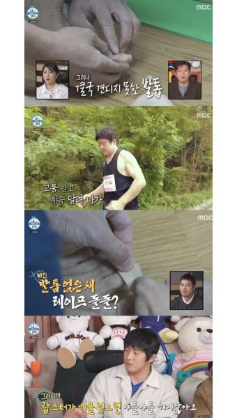 '나혼산' 기안84, 마라톤 탓 빠진 발톱→다시 얹어 테이핑 