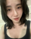 권민아, 근황 공개 “피부과 그만둔 상태”