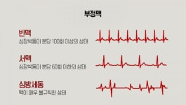 생로병사의 비밀 심박수 정상수치, 당신의 심박수는 몇입니까?