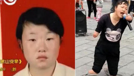 ‘사지 절단’된 채 구걸하는 여성이 잃어버린 딸 같다는 어머니 [토픽]