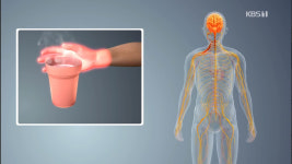 생로병사의 비밀 극복할 수 있는 방법은 없을까, 만성통증이란?