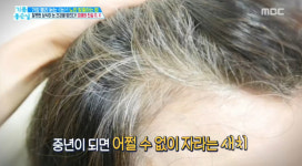 기분좋은 날 노안, 새치염색을 자주 하면 눈이 나빠진다? ··· 진실은?