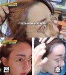 BJ 고은, 의료법위반 논란으로 구설수…현재 확인 중