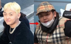 건강 걱정될 정도…래퍼 수퍼비(슈퍼비), 충격적인 근황 공개