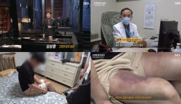 "살점이 다 떨어져 나갔다" '그알' 여수 졸음쉼터 살인사건, 끝장 토론→휴대전화 포렌식 복원…돌찍기 지시자 포착 '경악' (2)