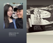 윤남기♥ 이다은, 둘째 리기 초음파 사진에 진짜 남기 주니어 흐뭇