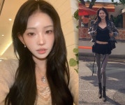 골반 괴사 최준희, 인공관절 수술 계획 밝혔다…로봇 관절 장착 예정