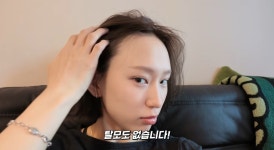 류혜영, '나 혼자 산다' 출연 후 탈모 의혹에 해명…
