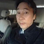 이문세, 백내장 수술 후 근황…