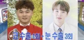 트로트가수 박서진, 과거 사진 화제... 