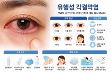 인공눈물 넣어도 계속 따갑다면… 전염력 강한 이 질환은?