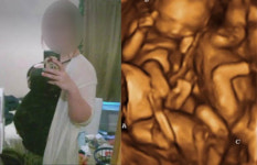 10대 소녀, 인터넷에서 가짜 초음파 사진 구매해 세쌍둥이 임신했다고 속여