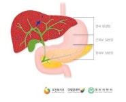 담도암, 일반적인 증상은? 담관 폐쇄에 의한 황달 