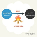  [탈모, 그것이 궁금하다①]  유전형 탈모와 DHT 