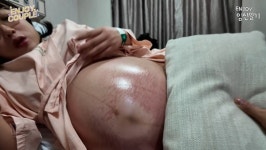 쌍둥이 출산 임라라, 다리·배 뒤덮은 두드러기에도…아기들 위해 버텼다(엔조이커플)