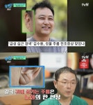 유재석 흉부외과 전문의 