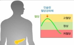 갑자기 '쿵'하며 다가오는 적신호…'저혈당 쇼크'