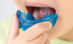 [칼럼] 초등학생 부정교합 치아교정의 장점 5가지