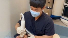 덴서티 알파 도입, 대구 더차오름의원 양극성·단극성 고주파 결합으로 대구 내 최다 시술 케이스 기록