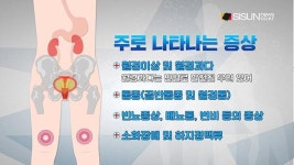 자궁근종, 가임기 여성이 필수로 알아야 하는 이유 [건강프라임-시선뉴스]