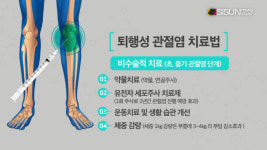 [건강프라임] 퇴행성 관절염은 완치가 가능할까? / 이유진 기자