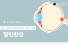 일요 건강정보! 몸이 천 냥이면 눈이 구백 냥...황반변성 주의 [인포그래픽]