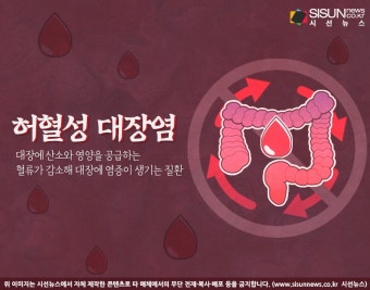 배우 이제훈으로 이슈된 '허혈성 대장염', 어떤 질병일까? [지식용어]