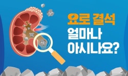 대한비뇨의학회 요로결석 얼마나 아시나요? 동영상 공개