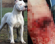 도고 아르헨티노에 물려 6번 수술…애견카페 알바생의 호소