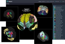인포메디텍, 뇌영상 분석 ‘Neuro I’ 식약처 인증