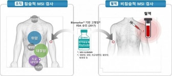 시선바이오머티리얼스, 대장암·위암 선별 기술 인정
