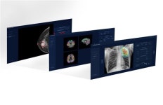 제이엘케이, AI 솔루션 3종 한신메디피아 납품