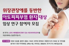 강동경희대한방병원, 아토피피부염환자 임상 연구 모집
