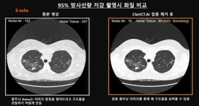 리더스내과영상의학과의원은 왜 ClariCT.AI를 도입했나?