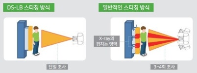 시화병원은 왜 DK메디칼솔루션 DSLB를 도입했나?