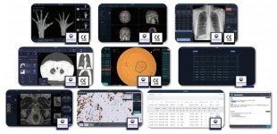 독자 기술력으로 의료 AI솔루션 10가지 상용화 성공