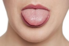 입 속에 생기는 ‘설암’, 특히 흡연·음주에 치명적