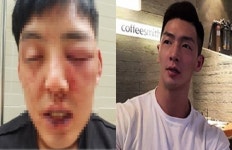 [쿠키영상] 차오름, 머슬마니아 양호석 폭행 고소 “남자답게 맞은 것뿐”…양호석 “시간 지나면 알게 된다”