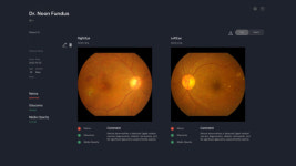 메디웨일 닥터눈 펀더스, 식약처 혁신의료기기 통합심사 승인