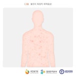 관심 급상승 풍진, 해외 여행 자제해야 하는 이유... 임산부와 어린이에게 더욱 위험 이유는?