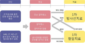 안와림프종치료  젊은층엔 약물, 중장년층 방사선
