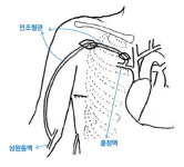 정맥폐쇄 투석환자에 새 동정맥루 수술법 개발  