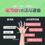 만성손목통증 유발 드퀘르벵건초염에는 부담적은 내시경요법