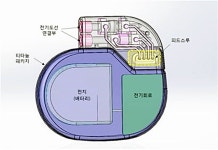 오송재단, 인체이식형 의료기기 핵심부품 특허등록