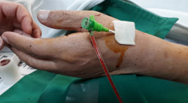 요골동맥 통한 심혈관 중재술 성공률 95% 이상