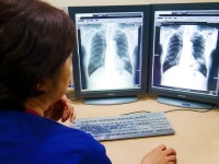 좋은문화병원, 흉부 X-ray 판독에 루닛 AI 활용