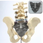 메디쎄이, 3D 프린팅 의료기기 실증사업 신정