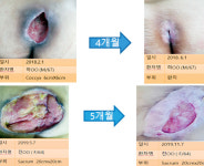 만성기의료협회, 요양병원 욕창 제로화 교육 나선다