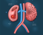 난치성 고혈압의 희망 신장신경차단술 36개월 효과 확인