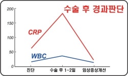 염증 진단 WBC로 충분한가? 이제 CRP로 염증 모니터링 한다